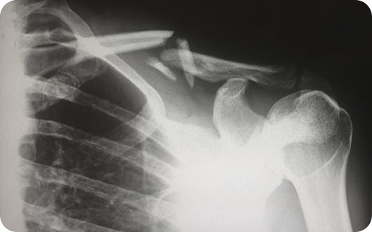 Personal Injury Law Hero Image